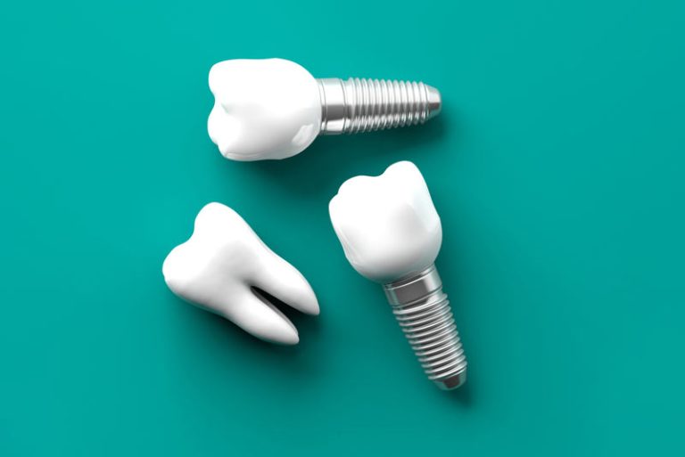 عوارض و معایب ایمپلنت کردن دندان
