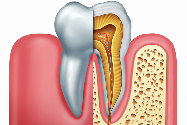آشنایی بیشتر با عصب کشی یا درمان ریشه دندان