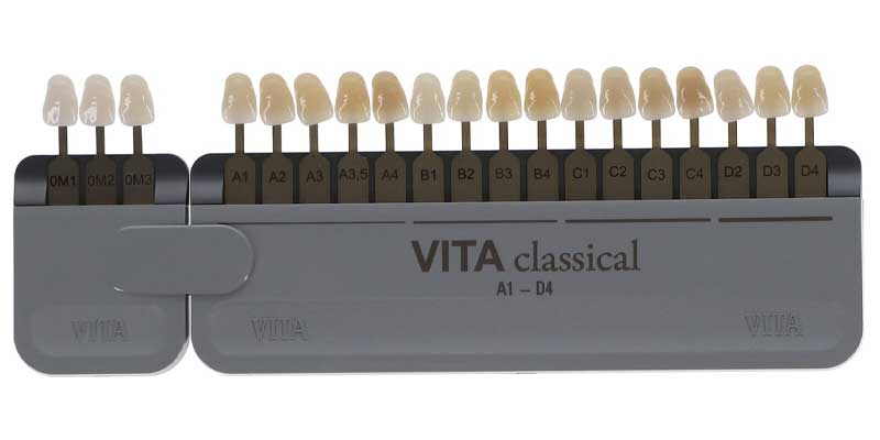 تفاوت رنگ دندان A1 و B1