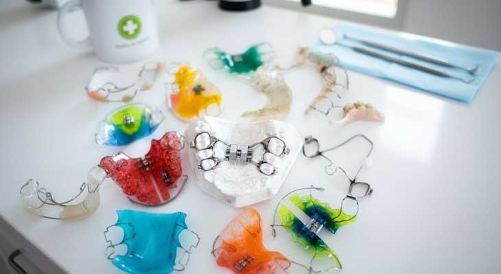 بهترین روش ارتودنسی