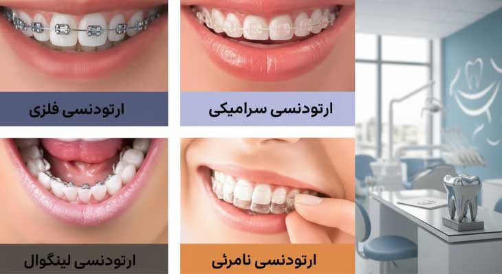 بهترین روش ارتودنسی