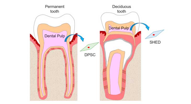 بهترین دکتر عصب کشی دندان در تهران
