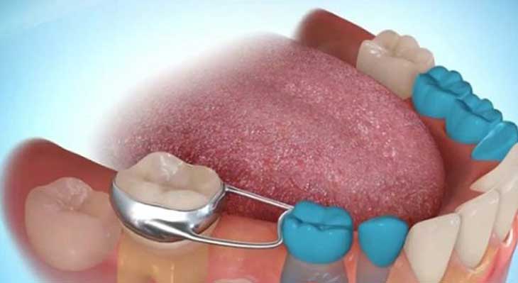 ارتودنسی پیشگیرانه