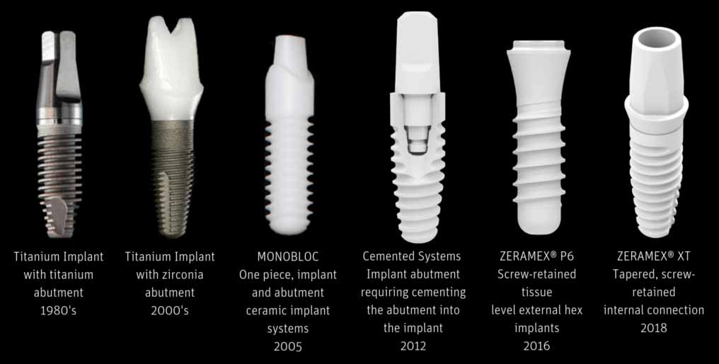 نوآوری ایمپلنت دندان