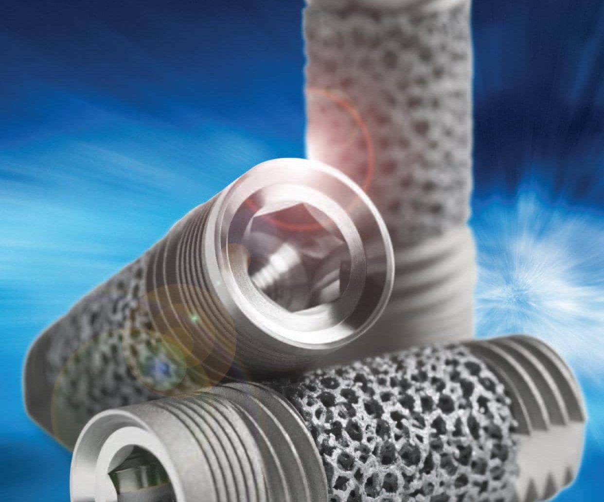 ایمپلنت آمریکایی دندان