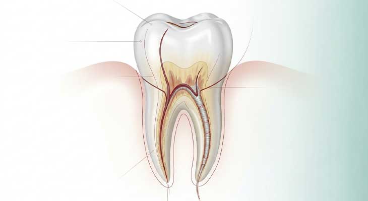 جراحی ریشه دندان
