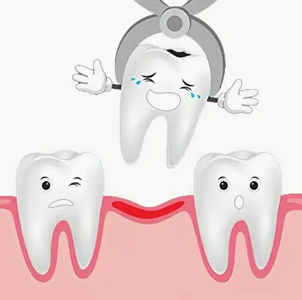 کشیدن دندان