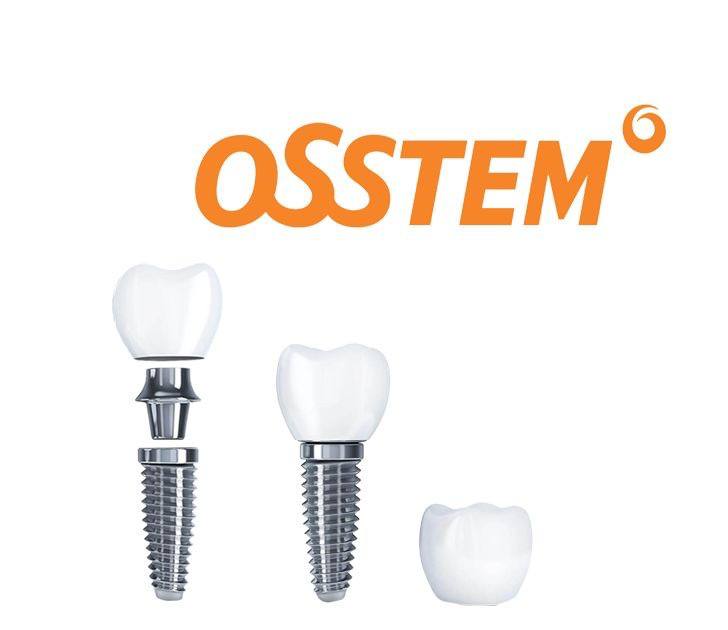 ایمپلنت اوستم