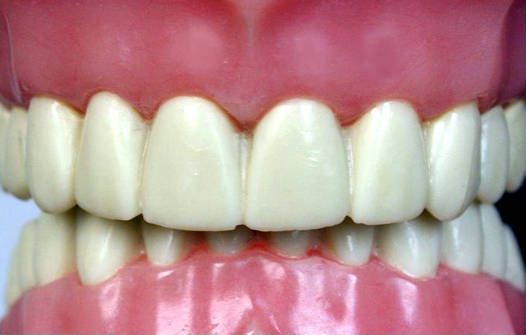 انواع بایت دندان: اوربایت