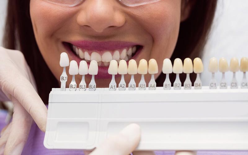 رنگ لمینت گروه a