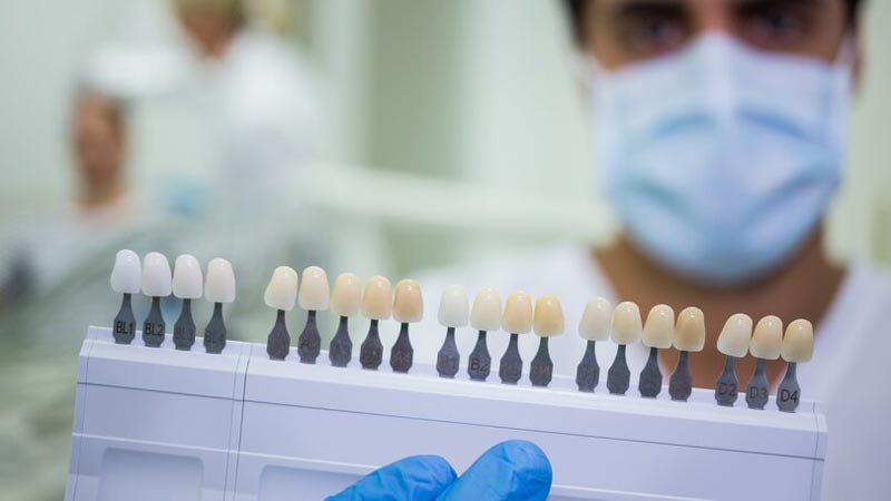 رنگ محبوب لمینت دندان