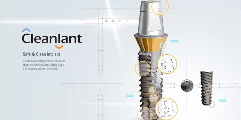 ایمپلنت کره ای دنتیس