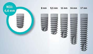 ایمپلنت پایه کوتاه