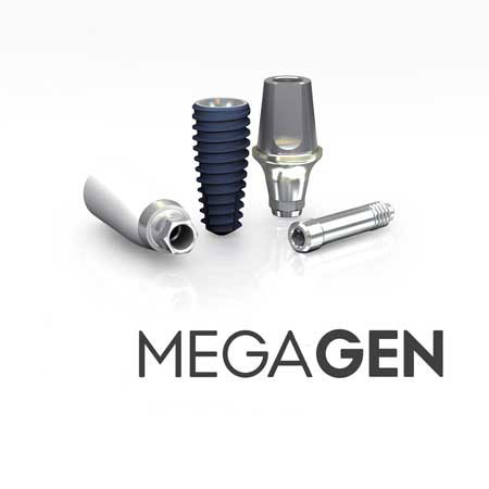 ایمپلنت مگاژن