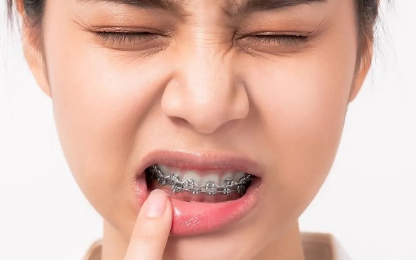 درد ارتودنسی