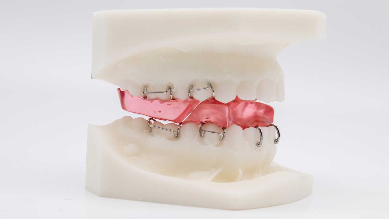 ارتودنسی فانکشنال