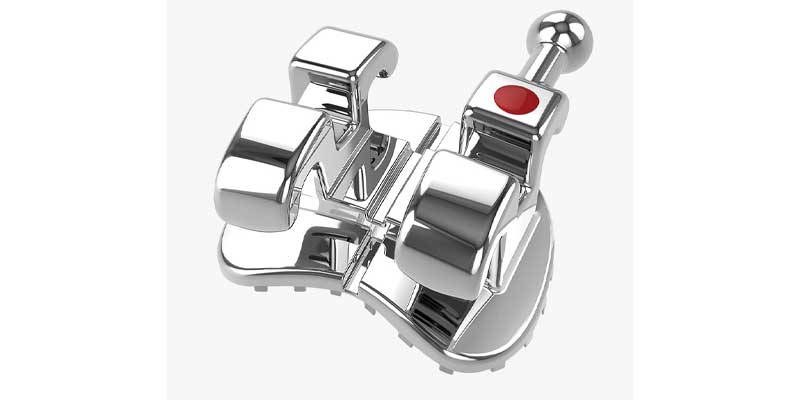 براکت ارتودنسی