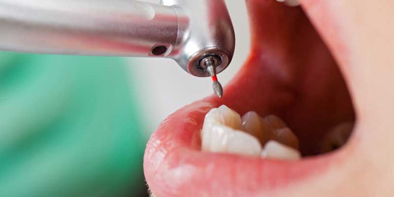 ترمیم دندان