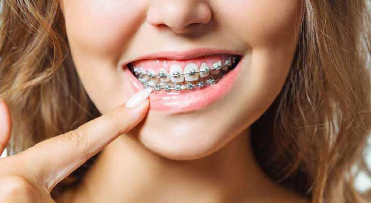 ارتودنسی در 40 سالگی و بالاتر