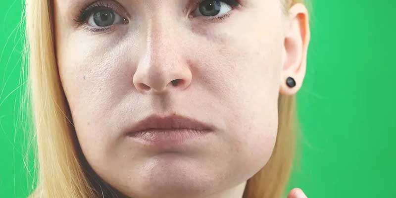 ورم صورت بعد از ایمپلنت دندان