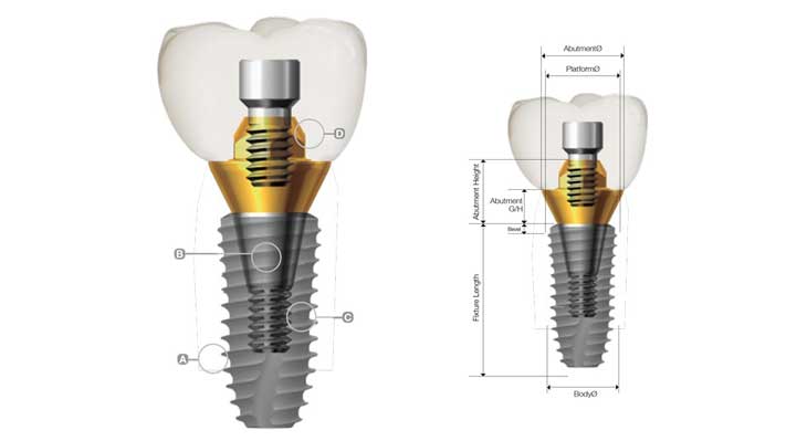 ایمپلنت دنتیوم