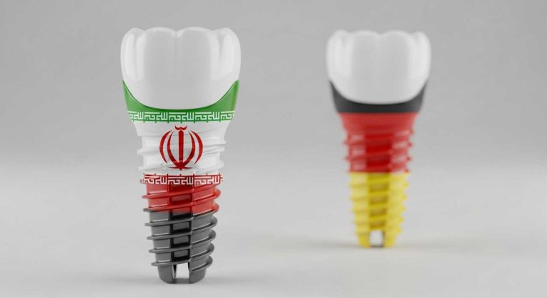 تفاوت ایمپلنت ایرانی و خارجی