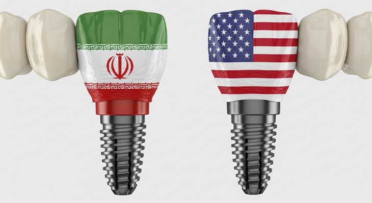 تفاوت ایمپلنت ایرانی و خارجی