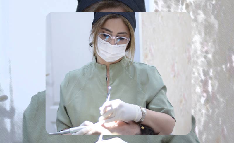 لمینت دندان اقساطی