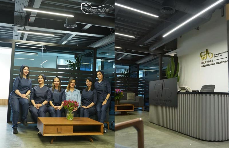 هزینه ایمپلنت دندان در شمال تهران