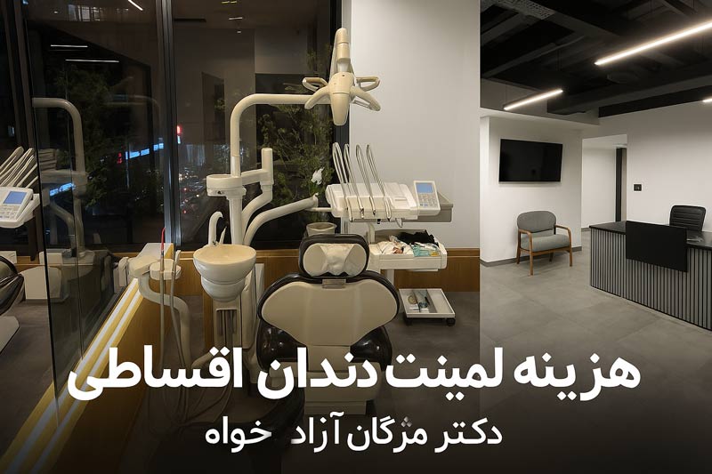 هزینه لمینت دندان اقساطی