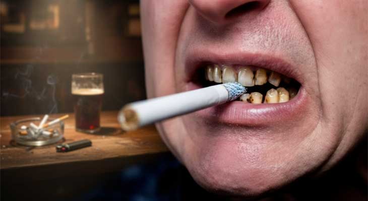 تاثیر سیگار بر کامپوزیت دندان