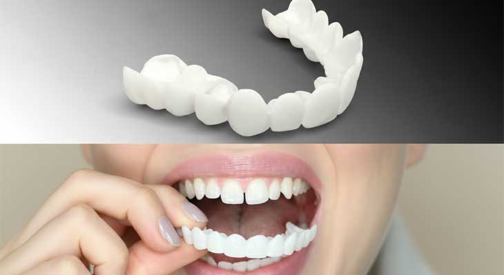 کامپوزیت متحرک دندان