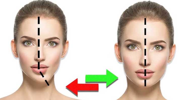 درمان فک نامتقارن و کج