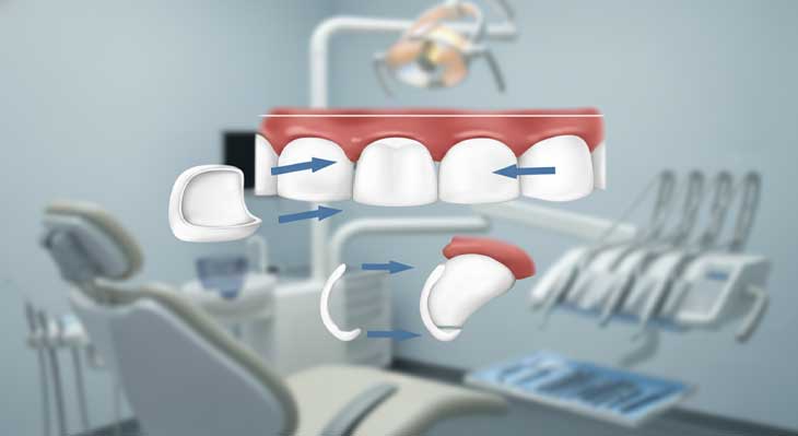 کامپوزیت متحرک دندان