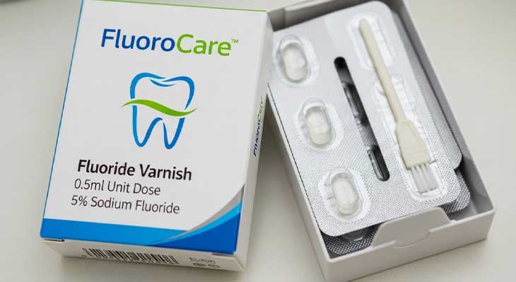 وارنیش فلوراید