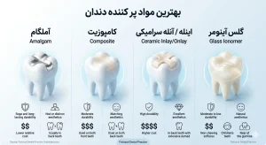 بهترین مواد پر کننده دندان برای دندان های جلو