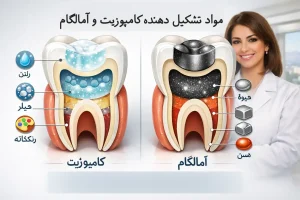 مواد تشکیل دهنده کامپوزیت و آمالگام