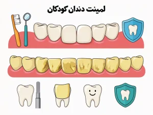 چه زمانی به لمینت دندان کودکان نیاز است؟