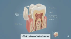 آیا لمینت دندان کودکان بی خطر است؟